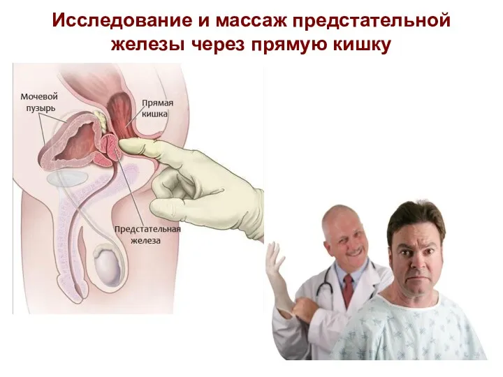 Исследование и массаж предстательной железы через прямую кишку Предстательная железа