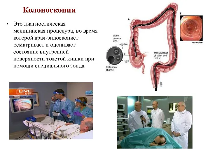 Колоноскопия Это диагностическая медицинская процедура, во время которой врач-эндоскопист осматривает