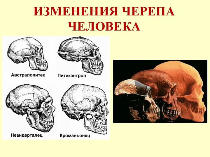 ИЗМЕНЕНИЯ ЧЕРЕПА ЧЕЛОВЕКА