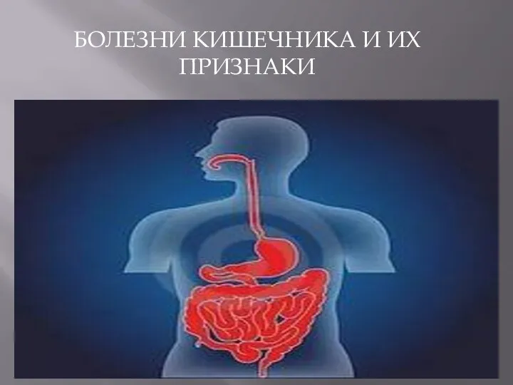 БОЛЕЗНИ КИШЕЧНИКА И ИХ ПРИЗНАКИ