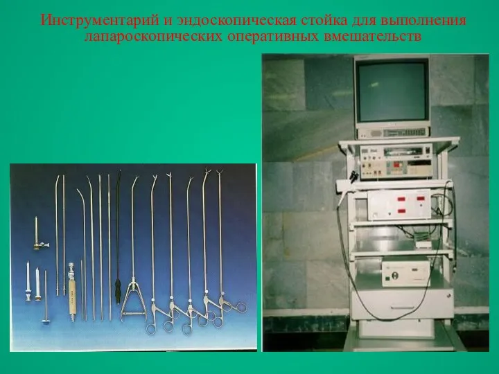Инструментарий и эндоскопическая стойка для выполнения лапароскопических оперативных вмешательств
