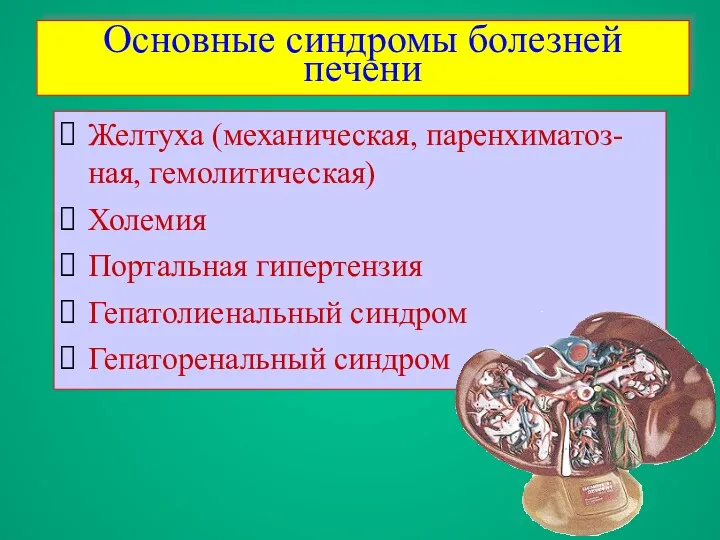 Основные синдромы болезней печени Желтуха (механическая, паренхиматоз-ная, гемолитическая)‏ Холемия Портальная гипертензия Гепатолиенальный синдром Гепаторенальный синдром