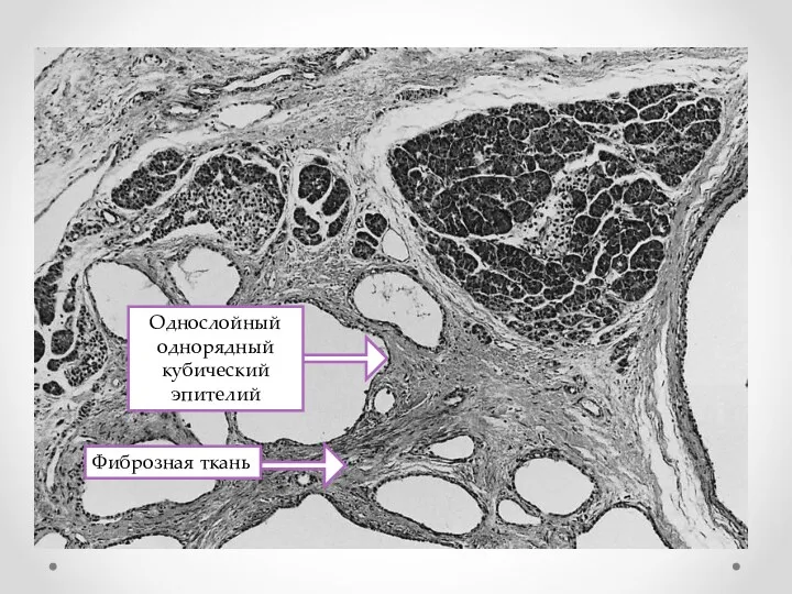 Однослойный однорядный кубический эпителий Фиброзная ткань