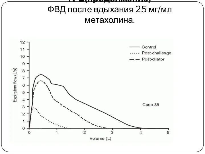 Клинический пример №2(продолжение) ФВД после вдыхания 25 мг/мл метахолина.