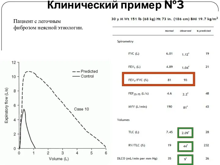 Клинический пример №3 Пациент с легочным фиброзом неясной этиологии.