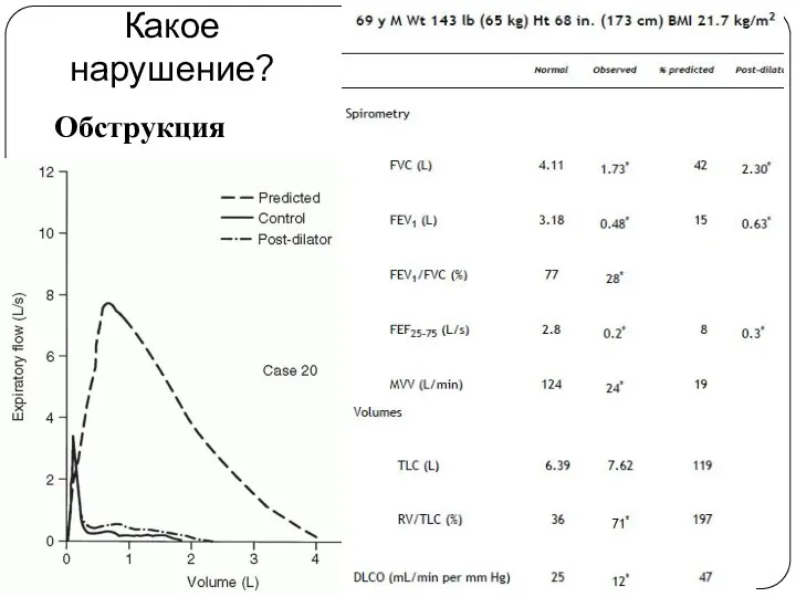 Какое нарушение? Обструкция