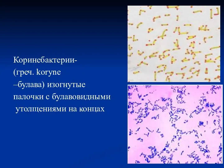Коринебактерии- (греч. koryne –булава) изогнутые палочки с булавовидными утолщениями на концах