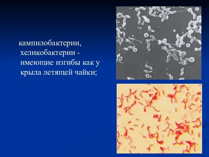 кампилобактерии, хеликобактерии - имеющие изгибы как у крыла летящей чайки;