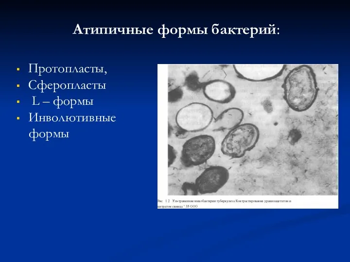 Атипичные формы бактерий: Протопласты, Сферопласты L – формы Инволютивные формы
