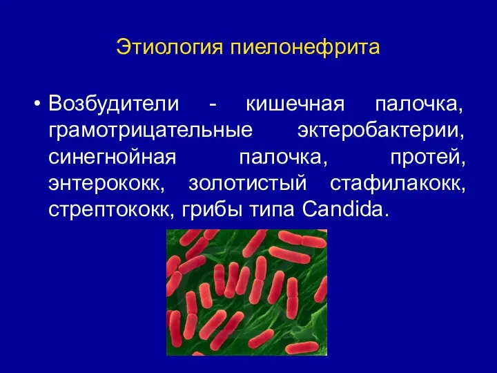 Этиология пиелонефрита Возбудители - кишечная палочка, грамотрицательные эктеробактерии, синегнойная палочка, протей, энтерококк, золотистый