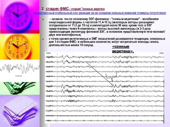 2 стадия ФМС - стадия "сонных веретен поверхностный стабильный сон