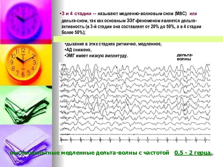 3 и 4 стадии -- называют медленно-волновым сном (МВС) или