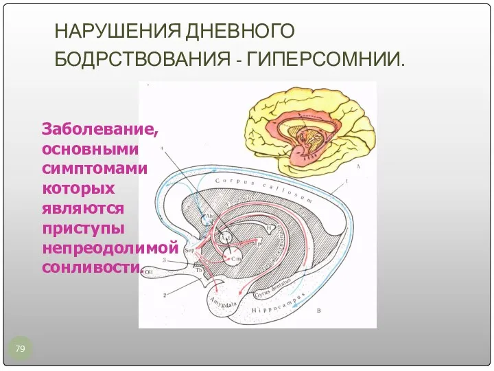 НАРУШЕНИЯ ДНЕВНОГО БОДРСТВОВАНИЯ - ГИПЕРСОМНИИ. Заболевание, основными симптомами которых являются приступы непреодолимой сонливости.