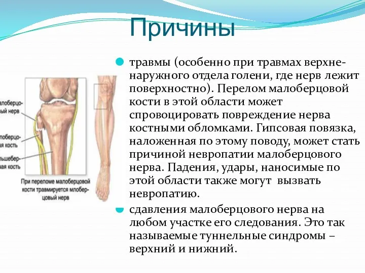 Причины травмы (особенно при травмах верхне-наружного отдела голени, где нерв