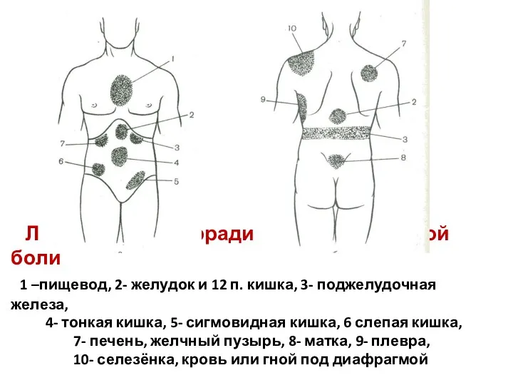 Локализация и иррадиация соматической боли 1 –пищевод, 2- желудок и