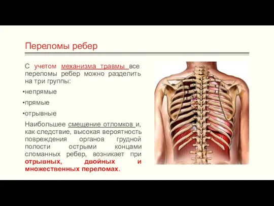 С учетом механизма травмы все переломы ребер можно разделить на