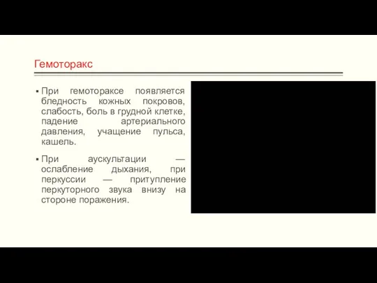 Гемоторакс При гемотораксе появляется бледность кожных покровов, слабость, боль в грудной клетке, падение