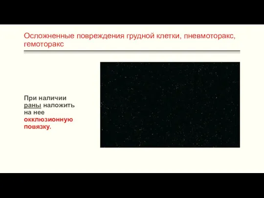 Осложненные повреждения грудной клетки, пневмоторакс, гемоторакс При наличии раны наложить на нее окклюзионную повязку.