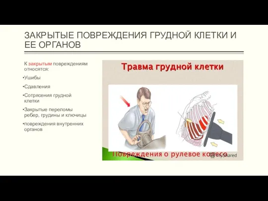 ЗАКРЫТЫЕ ПОВРЕЖДЕНИЯ ГРУДНОЙ КЛЕТКИ И ЕЕ ОРГАНОВ К закрытым повреждениям