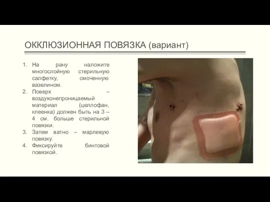 ОККЛЮЗИОННАЯ ПОВЯЗКА (вариант) На рану наложите многослойную стерильную салфетку, смоченную вазелином. Поверх –