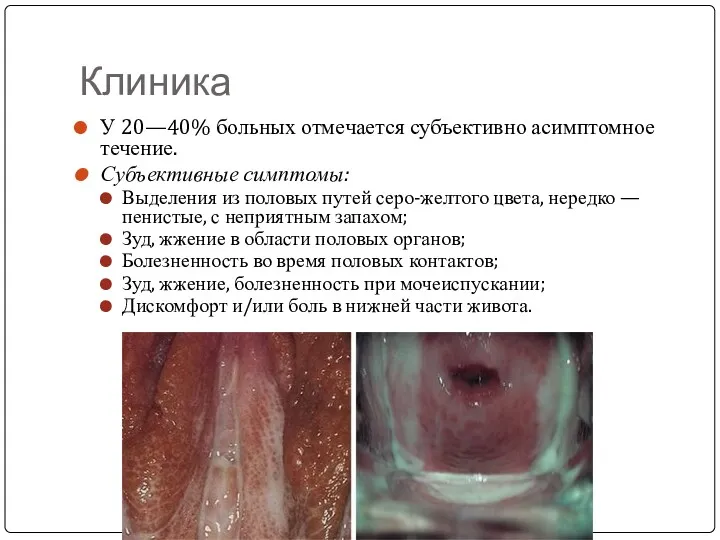 Клиника У 20—40% больных отмечается субъективно асимптомное течение. Субъективные симптомы: