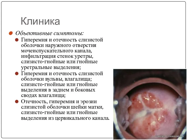 Клиника Объективные симптомы: Гиперемия и отечность слизистой оболочки наружного отверстия