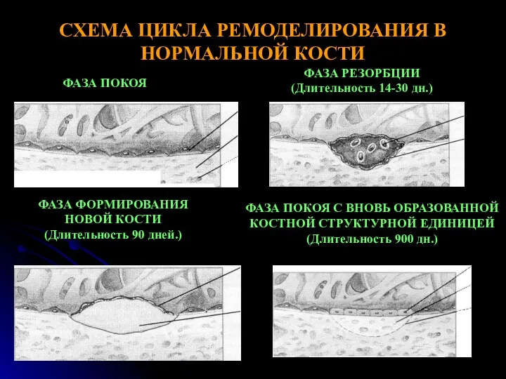 СХЕМА ЦИКЛА РЕМОДЕЛИРОВАНИЯ В НОРМАЛЬНОЙ КОСТИ ФАЗА ПОКОЯ ФАЗА РЕЗОРБЦИИ