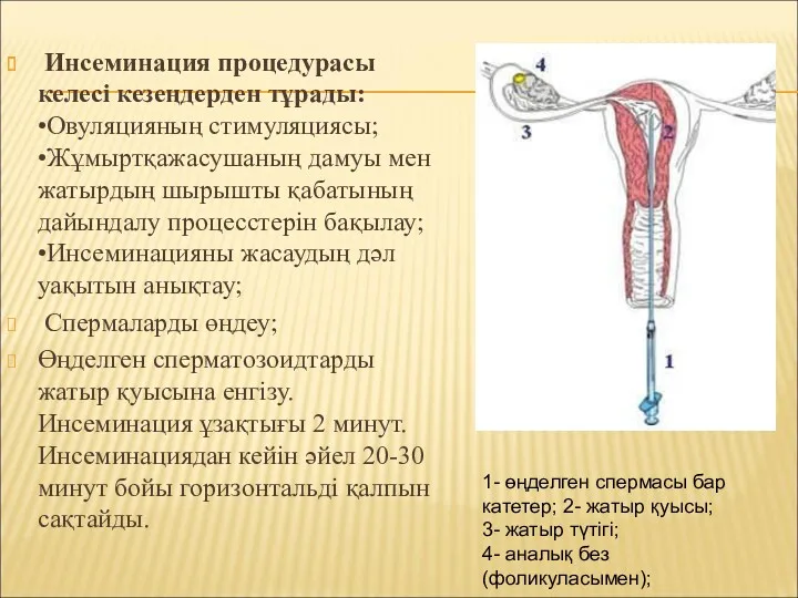 Инсеминация процедурасы келесі кезеңдерден тұрады: •Овуляцияның стимуляциясы; •Жұмыртқажасушаның дамуы мен