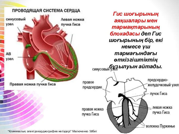 Гис шоғырының аяқшалары мен тармақтарының блокадасы деп Гис шоғырының бір,