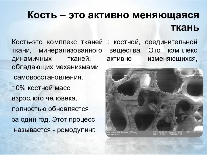 Кость – это активно меняющаяся ткань Кость-это комплекс тканей :