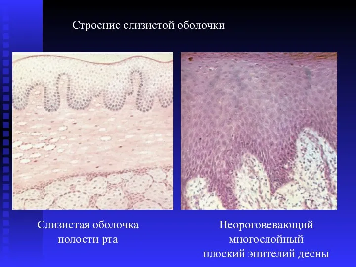 Строение слизистой оболочки Слизистая оболочка полости рта Неороговевающий многослойный плоский эпителий десны