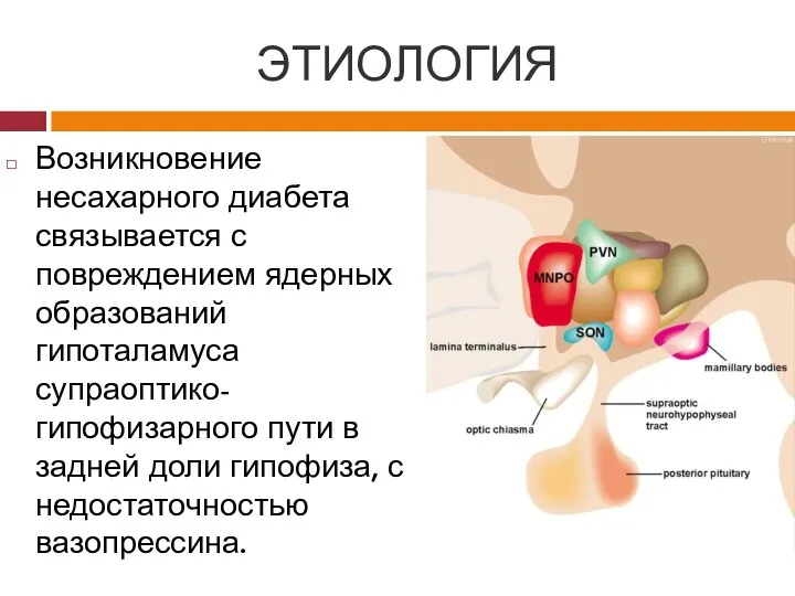 ЭТИОЛОГИЯ Возникновение несахарного диабета связывается с повреждением ядерных образований гипоталамуса