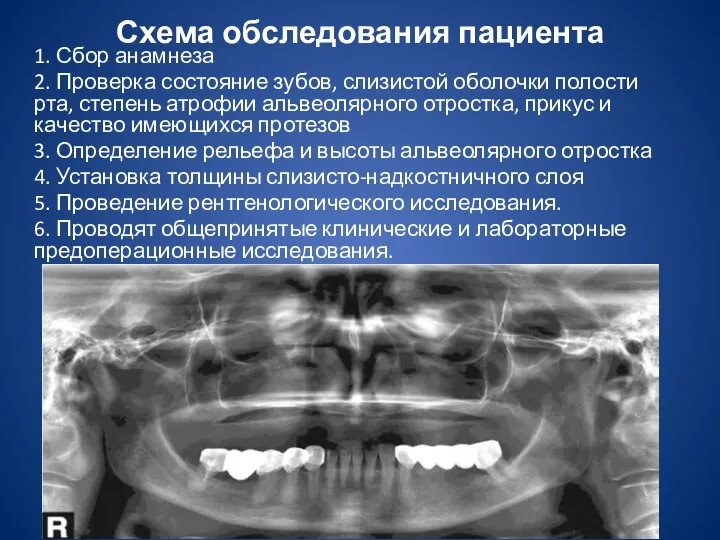 Схема обследования пациента 1. Сбор анамнеза 2. Проверка состояние зубов,