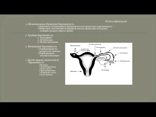 Классификация а. Абдоминальная (брюшная) беременность 1.Первичную (имплантация в брюшной полости