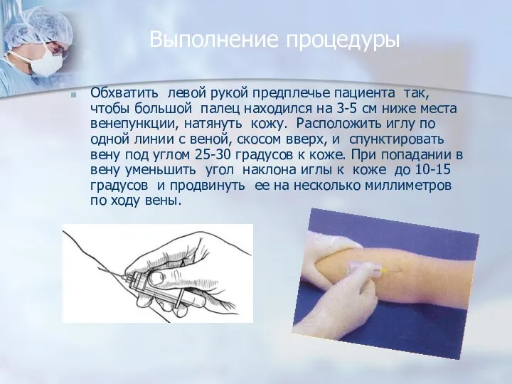 Обхватить левой рукой предплечье пациента так, чтобы большой палец находился