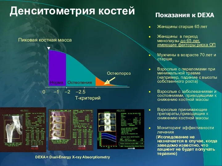 Денситометрия костей T-критерий 0 –1 –2 –2.5 Пиковая костная масса