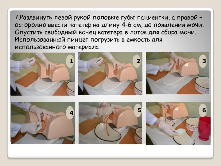 7.Раздвинуть левой рукой половые губы пациентки, а правой – осторожно ввести катетер на