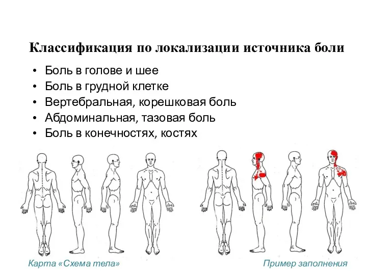 Классификация по локализации источника боли Боль в голове и шее