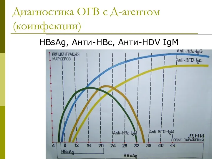 Диагностика ОГВ с Д-агентом (коинфекции) HBsAg, Анти-HBc, Анти-HDV IgM