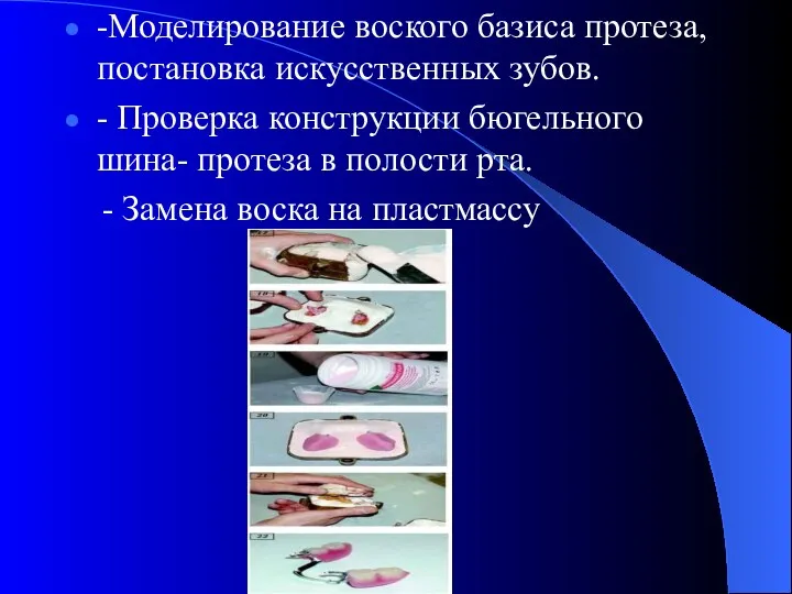 -Моделирование воского базиса протеза, постановка искусственных зубов. - Проверка конструкции