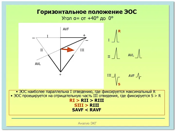 Анализ ЭКГ Горизонтальное положение ЭОС Угол α= от +40° до