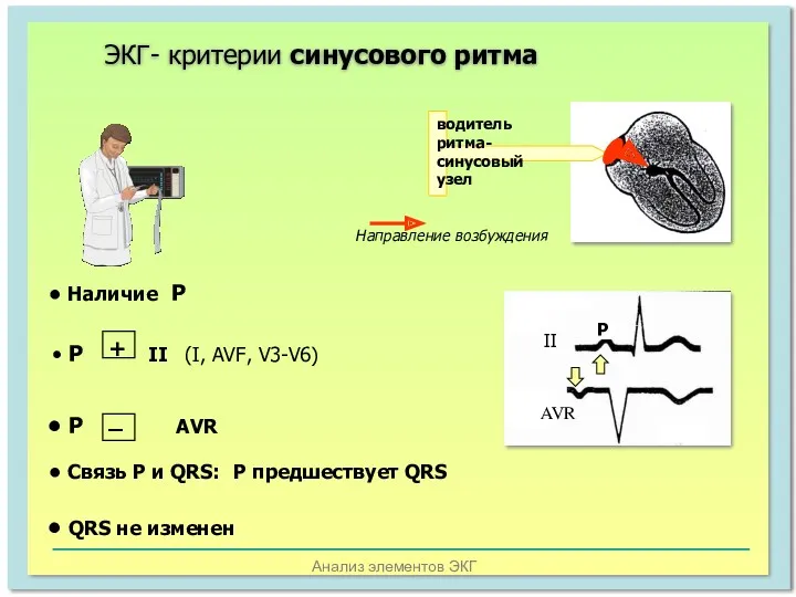 Анализ элементов ЭКГ водитель ритма- синусовый узел ЭКГ- критерии синусового ритма Р II AVR Направление возбуждения