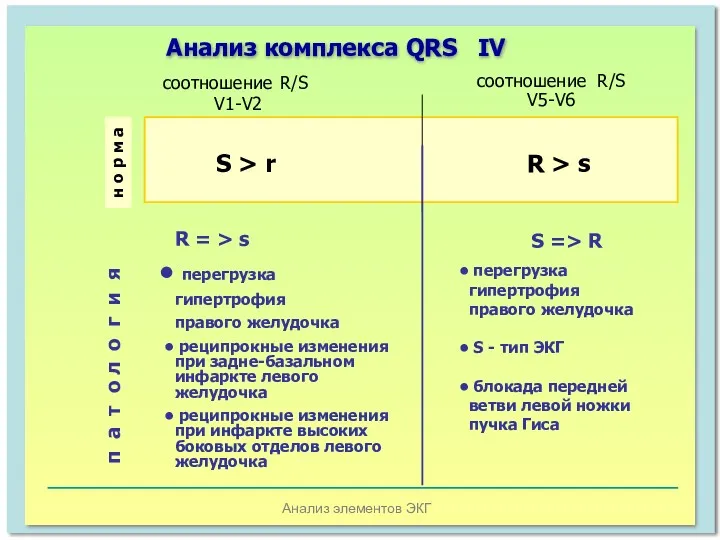 Анализ элементов ЭКГ Анализ комплекса QRS IV S > r