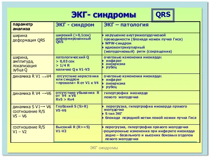 ЭКГ синдромы ЭКГ- синдромы QRS