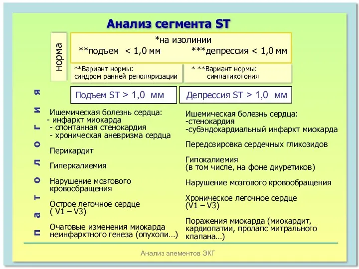 Анализ элементов ЭКГ Анализ сегмента SТ Подъем ST > 1,0