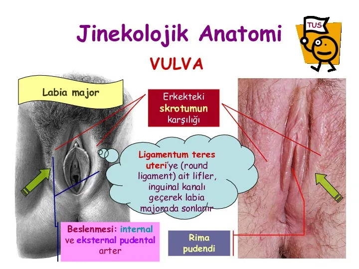 Jinekolojik Anatomi VULVA Ligamentum teres uteri’ye (round ligament) ait lifler, inguinal kanalı geçerek