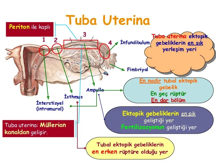 Tuba Uterina Tuba uterina: Müllerian kanaldan gelişir. 1 2 3 4 İnterstisyel (intramural)