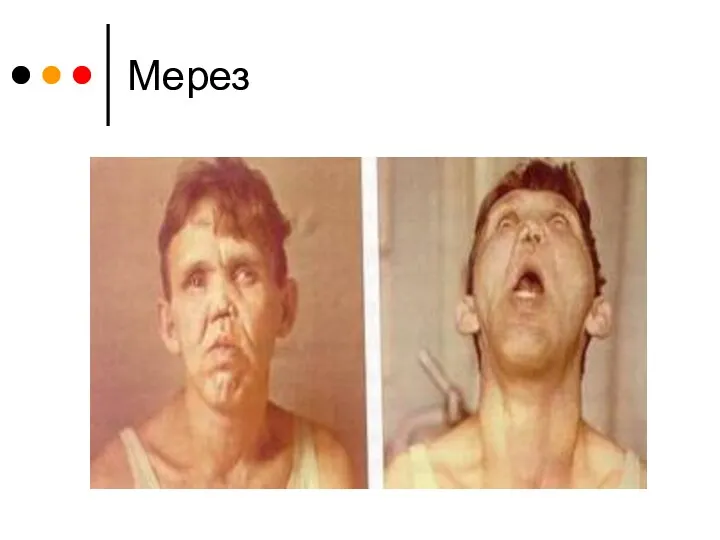 Мерез