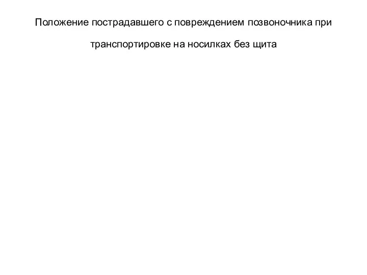 Положение пострадавшего с повреждением позвоночника при транспортировке на носилках без щита