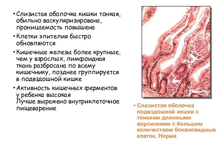 Слизистая оболочка кишки тонкая, обильно васкуляризирована, проницаемость повышена Клетки эпителия